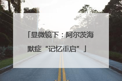 显微镜下：阿尔茨海默症“记忆重启”